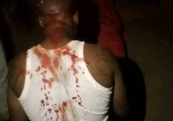 Ogłoszenie - +2348106233580 #how can I join Illuminati occult society for money ritual without human sacrifice in Port  Harcourt. Zdjęcie 1