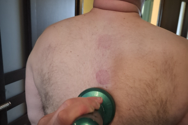 Ogłoszenie - MASAŻE TERAPIA DIETETYKA. Zdjęcie 6