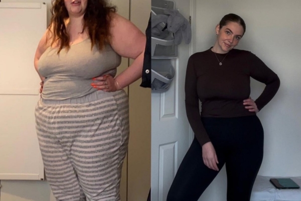 Ogłoszenie - Kup Rubifen, Ritalin, Concerta, Adderall, Mounjaro, Sibutramina, Dysport, Botox, Restylane, Surgiderm itp.. Zdjęcie 1