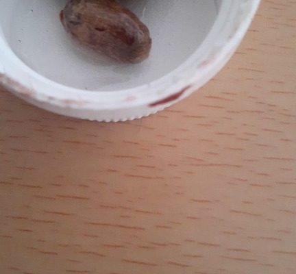 Ogłoszenie - Manhood enlargement has become a popular topic among men seeking to enhance their confidence and sexual satisfaction.. Zdjęcie 3