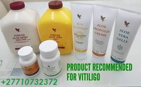 Ogłoszenie - Get Rid Of Vitiligo In Vaasa City In Finland Call +27710732372 Scars And Stretch Marks In Asomatos In Kyrenia, Cyprus. Zdjęcie 2