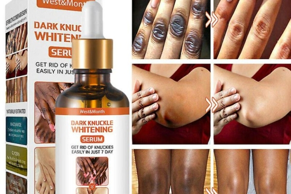 Ogłoszenie - Dark Knuckle Whitening Serum In Oman, Knee Brightening Serum In Agios Georgios In Kyrenia, Cyprus Call ☏ +2771 073 2372. Zdjęcie 1