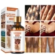 Ogłoszenie - Dark Knuckle Whitening Serum In Oman, Knee Brightening Serum In Agios Georgios In Kyrenia, Cyprus Call ☏ +2771 073 2372. Miniaturka 1